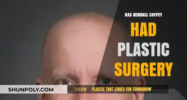 Kendall Coffey Plastic Surgery: Fact-Checking the Rumors and Speculations