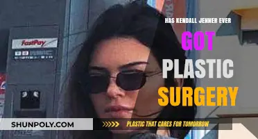 Kendall Jenner's Transformation: Plastic Surgery Rumors and Reality
