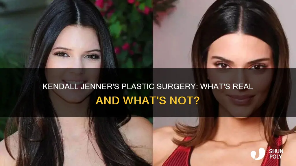 has kendall jenner gotten plastic sugery