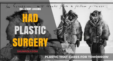 Kenny Loggins Plastic Surgery: Fact-Checking the Rumors and Speculations
