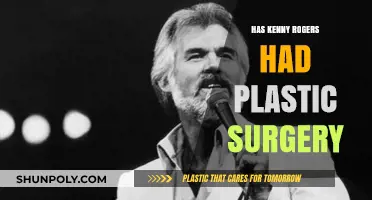 Kenny Rogers' Transformation: Plastic Surgery Speculations and Truths Revealed