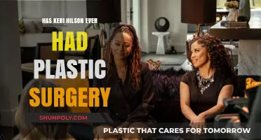 Keri Hilson's Transformation: Plastic Surgery Rumors Explored and Debunked