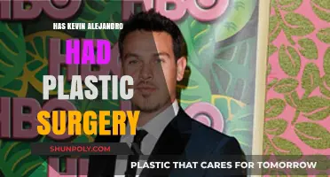 Kevin Alejandro's Transformation: Plastic Surgery Rumors Explored