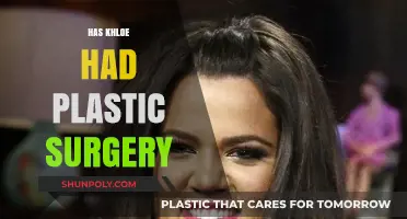 Khloe Kardashian's Transformation: Plastic Surgery Rumors and Reality Revealed