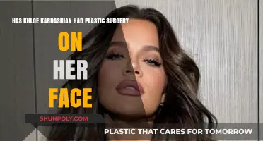 Khloe Kardashian's Face Transformation: Plastic Surgery or Natural Glow?