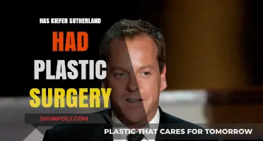 Kiefer Sutherland's Changing Looks: Plastic Surgery Rumors Explored