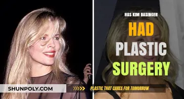 Kim Basinger's Transformation: Plastic Surgery Rumors and Reality Revealed