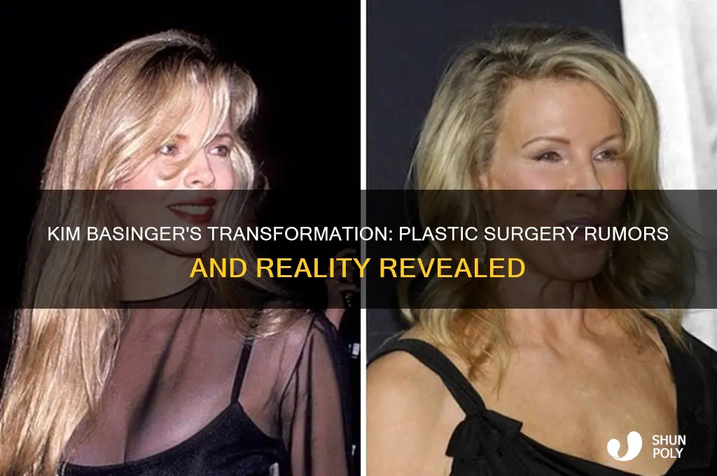 has kim basinger had plastic surgery