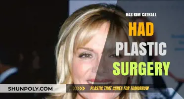 Kim Catrall's Transformation: Plastic Surgery Rumors Explored