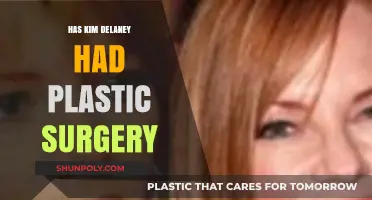 Kim Delaney's Transformation: Plastic Surgery Speculations and Truths Revealed