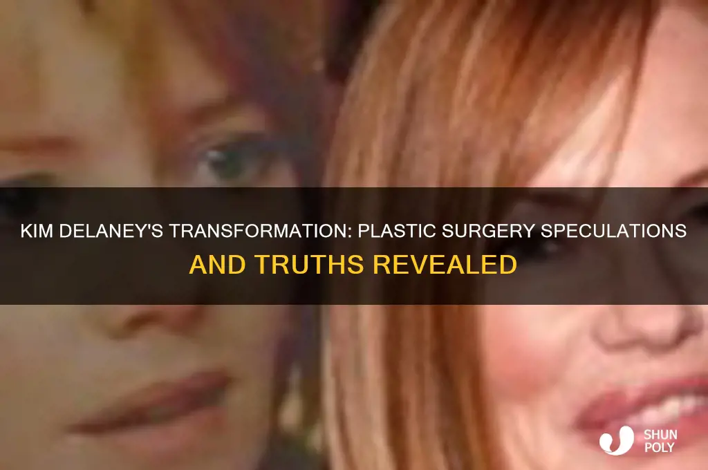 has kim delaney had plastic surgery