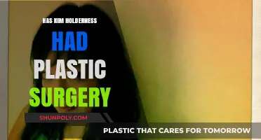 Kim Holderness Plastic Surgery: Fact-Checking the Transformation Rumors