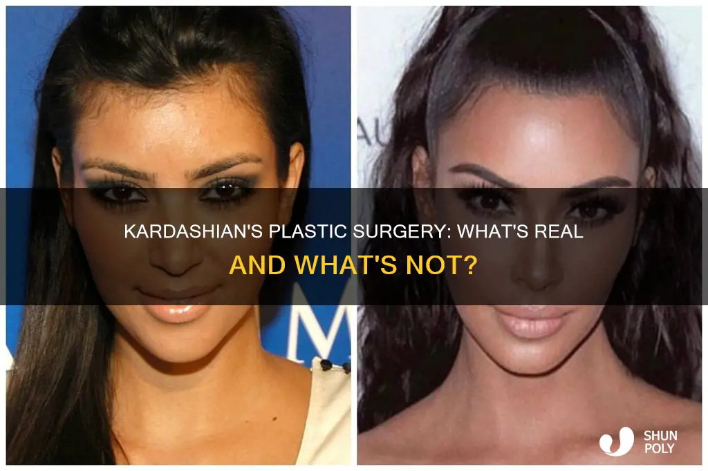 has kim kardashian had plastic sugery