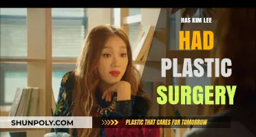 Kim Lee's Transformation: Plastic Surgery Speculations and Truths Revealed