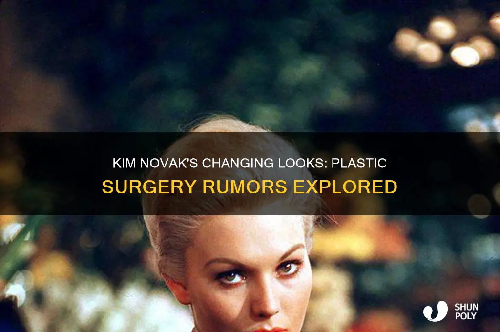 has kim novak had plastic surgery
