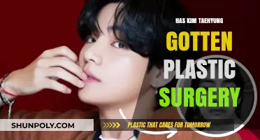 Kim Taehyung's Transformation: Plastic Surgery Speculations and Facts