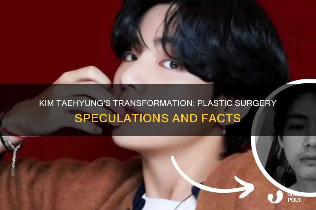 has kim taehyung gotten plastic surgery