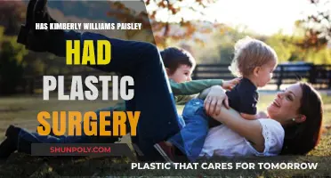 Kimberly Williams-Paisley Plastic Surgery: Fact-Checking the Rumors and Speculations
