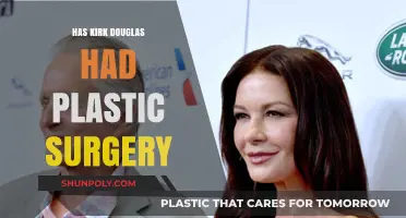 Kirk Douglas Plastic Surgery: Fact or Fiction? Unveiling the Truth