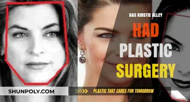 Kirstie Alley's Transformation: Plastic Surgery Rumors and Speculations