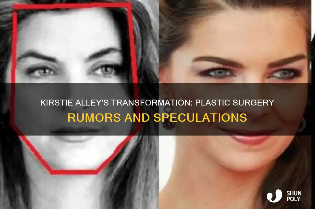 has kirstie alley had plastic surgery