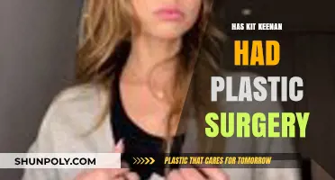 Kit Keenan Plastic Surgery: Fact-Checking the Rumors and Speculations