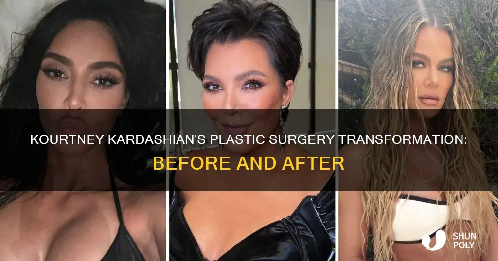 has kourtney kardashian had plastic surgeyr