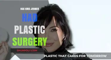 Kris Jenner's Transformation: Plastic Surgery Speculations and Truths Revealed