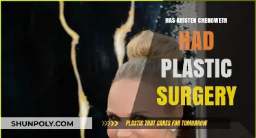 Kristen Chenoweth's Transformation: Plastic Surgery Speculations and Truths
