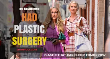 Kristen Davis Plastic Surgery: Fact-Checking the Rumors and Speculations