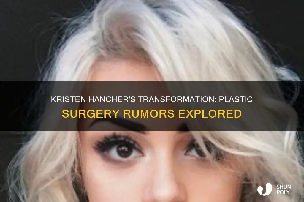has kristen hancher get plastic surgery