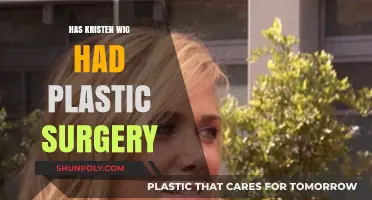 Kristen Wiig's Transformation: Plastic Surgery Rumors Explored and Debunked