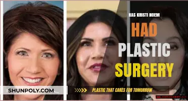 Kristi Noem Plastic Surgery: Fact-Checking the Rumors and Speculations