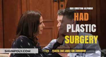 Kristian Alfonso's Transformation: Plastic Surgery Rumors and Speculations