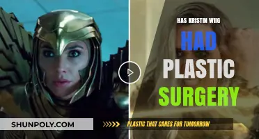 Kristen Wiig's Transformation: Plastic Surgery Rumors and Speculations