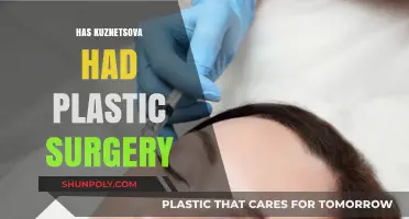 Has Svetlana Kuznetsova Undergone Plastic Surgery? Examining the Rumors