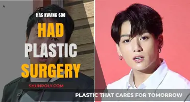 Kwang Soo Plastic Surgery: Fact-Checking Rumors and Speculations