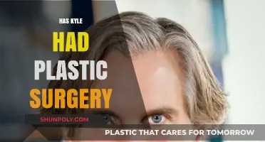 Kyle's Transformation: Plastic Surgery Rumors and the Truth Behind Them