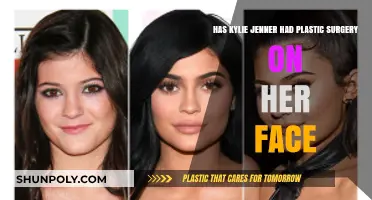 Kylie Jenner's Facial Transformation: Plastic Surgery or Natural Glow-Up?
