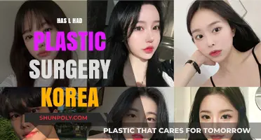 Has L Had Plastic Surgery? Unveiling the K-Pop Star's Transformation in Korea