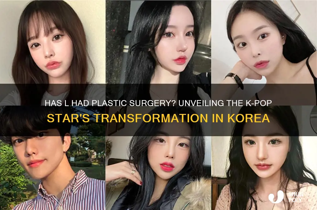 has l had plastic surgery korea
