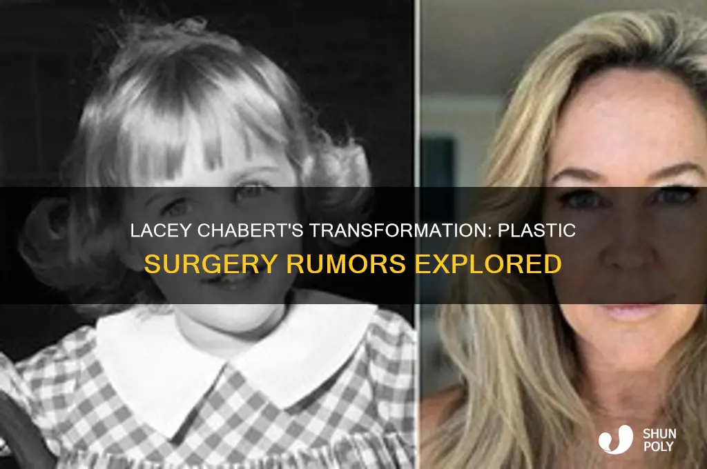 has lacey chabert had plastic surgery