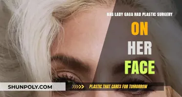 Lady Gaga's Facial Transformation: Plastic Surgery Speculations Explored