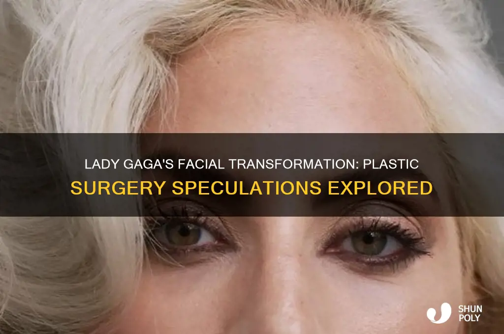 has lady gaga had plastic surgery on her face