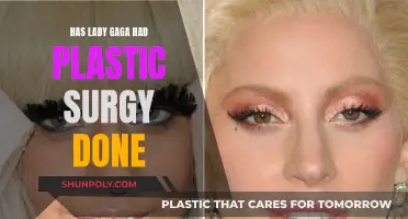Lady Gaga's Plastic Surgery: What's Real?