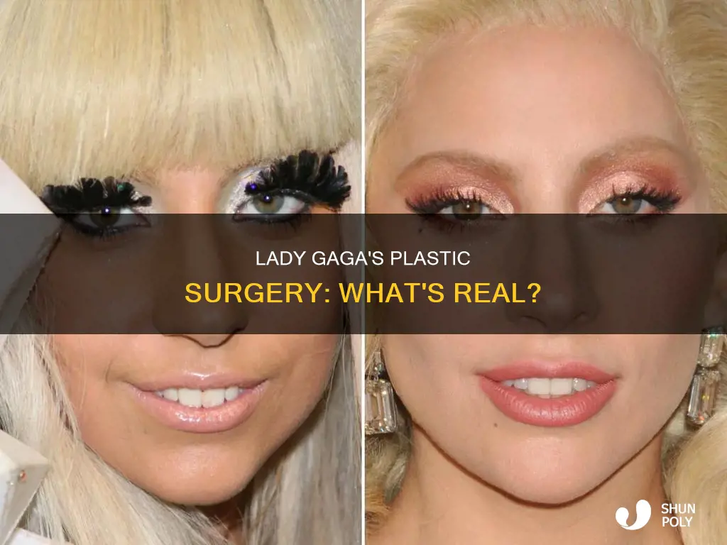 has lady gaga had plastic surgy done