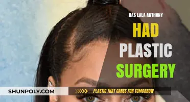 Lala Anthony's Transformation: Plastic Surgery Rumors and Speculations Explored
