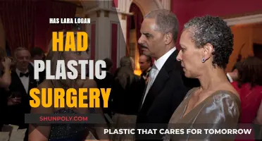 Lara Logan Plastic Surgery: Fact-Checking Rumors and Speculations