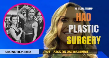 Lara Trump's Transformation: Plastic Surgery Speculations and Facts Revealed