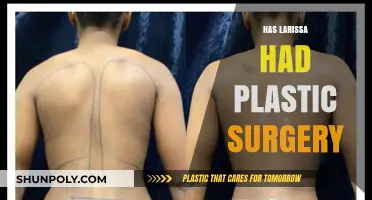 Has Larissa Had Plastic Surgery? Uncovering the Truth Behind Her Look